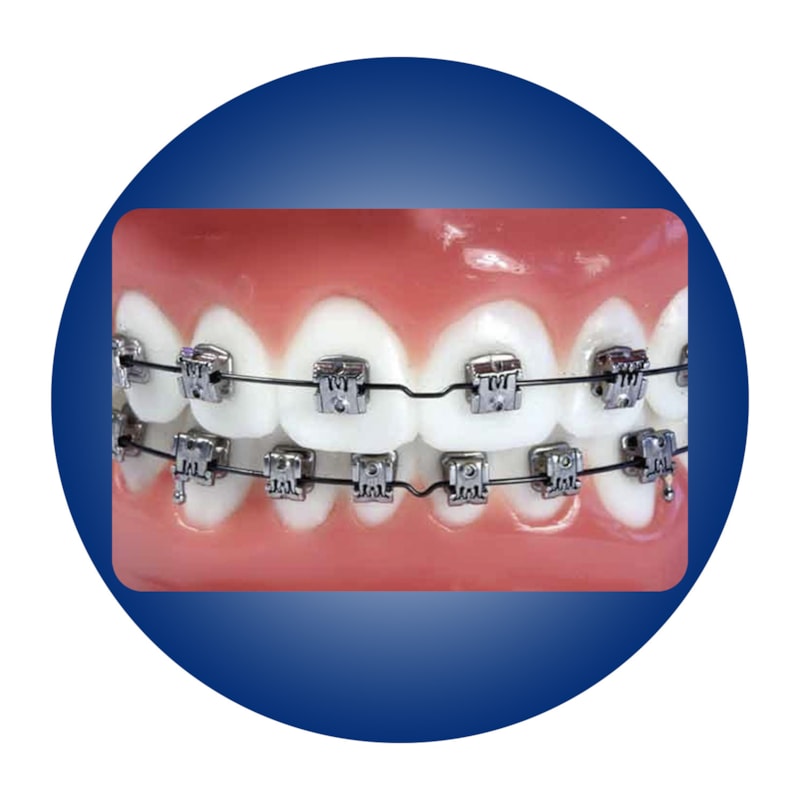 Bracket AutoLigado Carriere SLX 022 5x5 Orthoghia