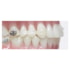 Carriere Motion 3D Clear (E)