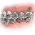 Miniparafuso Ortodôntico Extrarradicular de Aço (Compr.: 5mm Transm.: 4mm Ø2mm)