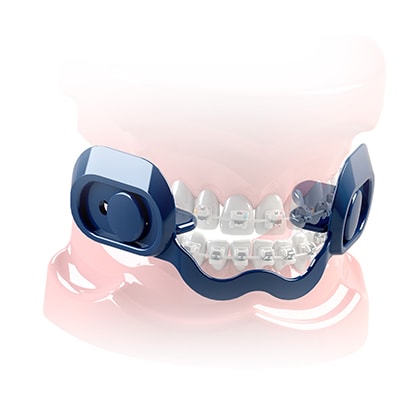 ORTHO PROTECTOR AZUL